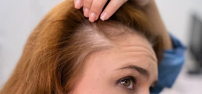 Who is SVF stem cell treatment suitable for