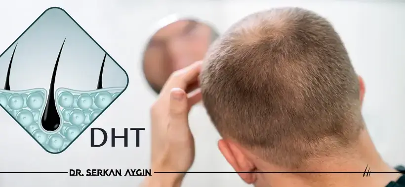 DHT Hair Loss & Regrow Hair